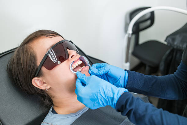 Best Chipped Tooth Repair Near Me  in Gloverville, SC
